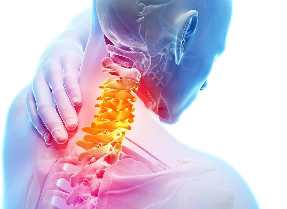 simptome de osteocondroză cervicală